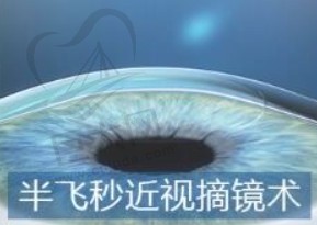 整形医院哪家好？做医美项目，公立VS私立，怎么挑？